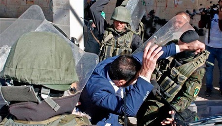 الاحتلال يواصل عدوانه على القدس ويصيب ويعتقل عددا من المواطنين في الضفة وغزة