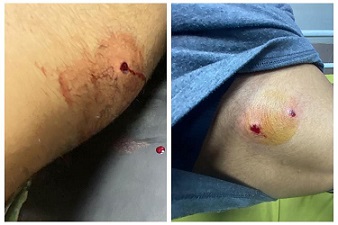 إصابة شابين واعتقال آخر خلال اقتحام الاحتلال لمخيم قلنديا