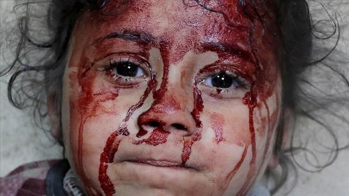 لازاريني: عدد قتلى أطفال غزة يفوق نظراءهم بحروب العالم آخر 4 سنوات