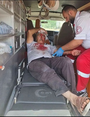 إصابة مسن بجروح ورضوض إثر اعتداء المستوطنين عليه شرق الخليل